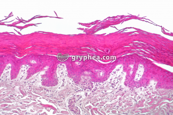 Epiderme CT x25 - gryphea.org
